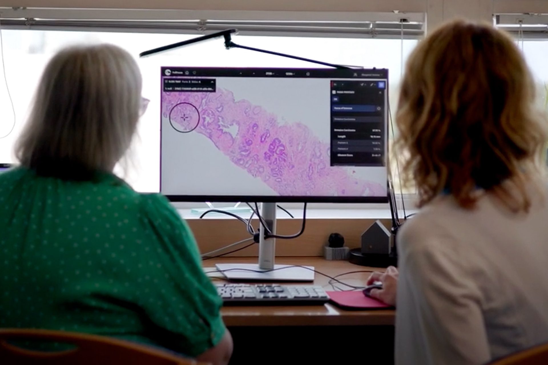 UK hospitals begin live trial of prostate cancer-detecting AI